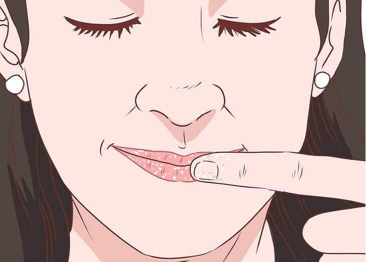 6 Tipps gegen rissige und trockene Lippen