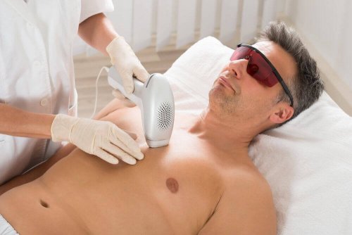 Laser-Haarentfernungen können Krebs verursachen