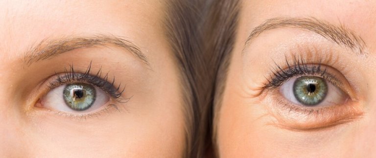 Wie du deine Augenlider mit 5 natürlichen Mitteln festigen kannst