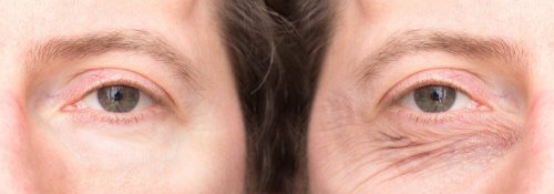 Augenlider mit natürlichen Mitteln festigen: Weitere Daten