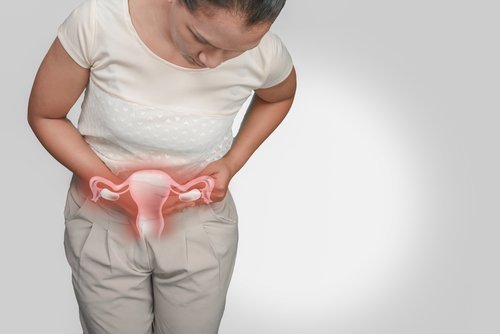 Myome können ein Grund sein für Unfruchtbarkeit bei Frauen