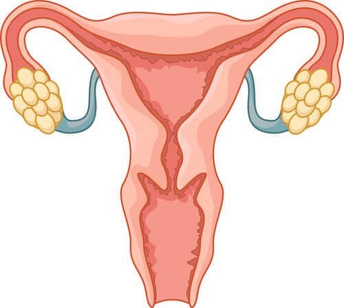 PCOS kann ein Grund sein für Unfruchtbarkeit bei Frauen