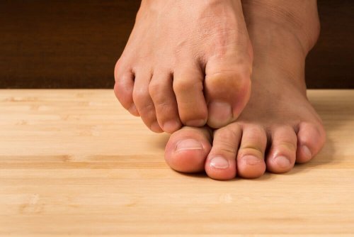 Pilzinfektion natürlich behandeln