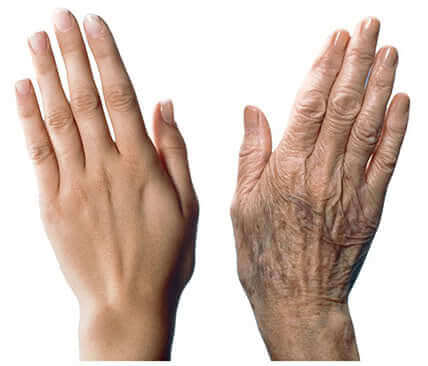 7 Tipps gegen Alterungserscheinungen an den Händen