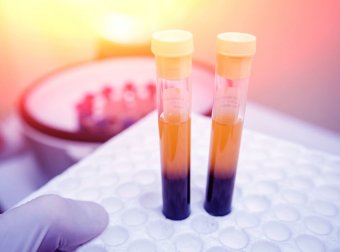 4 Naturmittel für höhere Thrombozytenwerte