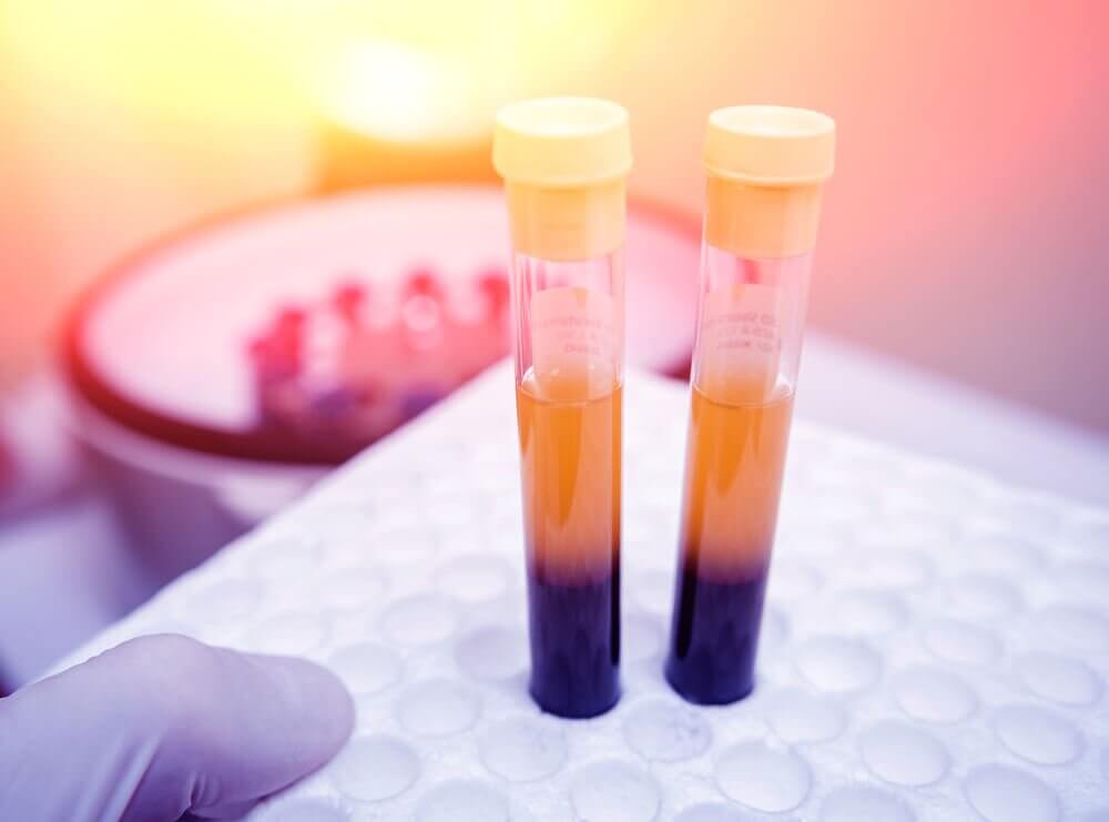 4 Naturmittel für höhere Thrombozytenwerte 4 Naturmittel für höhere Thrombozytenwerte