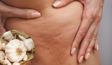 Mit diesen 5 Mitteln kannst du Cellulite behandeln