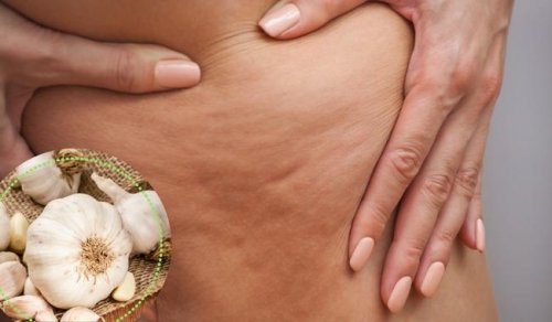 Mit diesen 5 Mitteln kannst du Cellulite behandeln