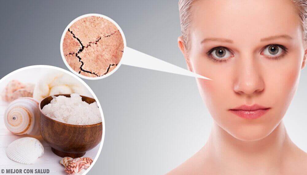 5 Natürliche Mittel gegen trockene Haut