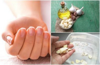 Schnelleres Wachstum der Fingernägel: 5 Tipps