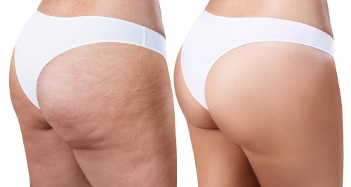 Rosmarin zur Straffung der Haut