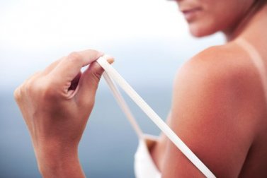 Sonnenbrand heilen: 5 natürliche Hausmittel