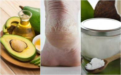 5 selbstgemacht Cremes gegen spröde Fersen