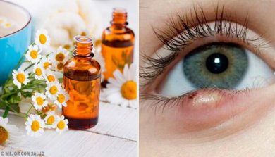 5 einfache Tricks zur Behandlung von Gerstenkörnern