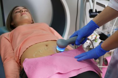 5 Symptome für polyzystische Ovarien