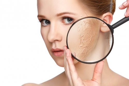 Mit diesen Tipps kannst du trockene Haut behandeln.