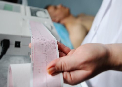 Wie wird ein Myokardinfarkt diagnostiziert