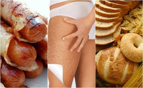 Diese Nahrungsmittel fördern Cellulite