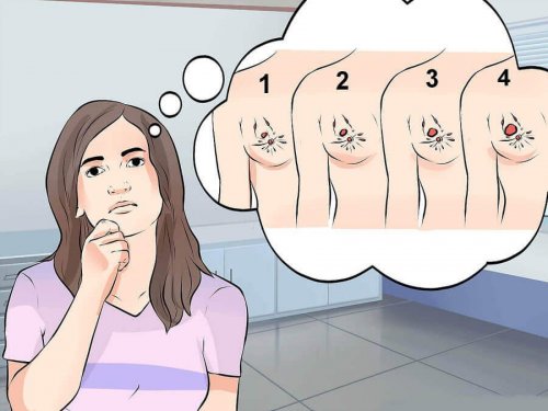 Brustkrebs führt zu Schmerzen im Arm