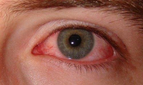 Rauchstopp um die Augen zu schützen.