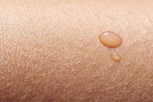 Trockene Haut durch Vitamindefizite.