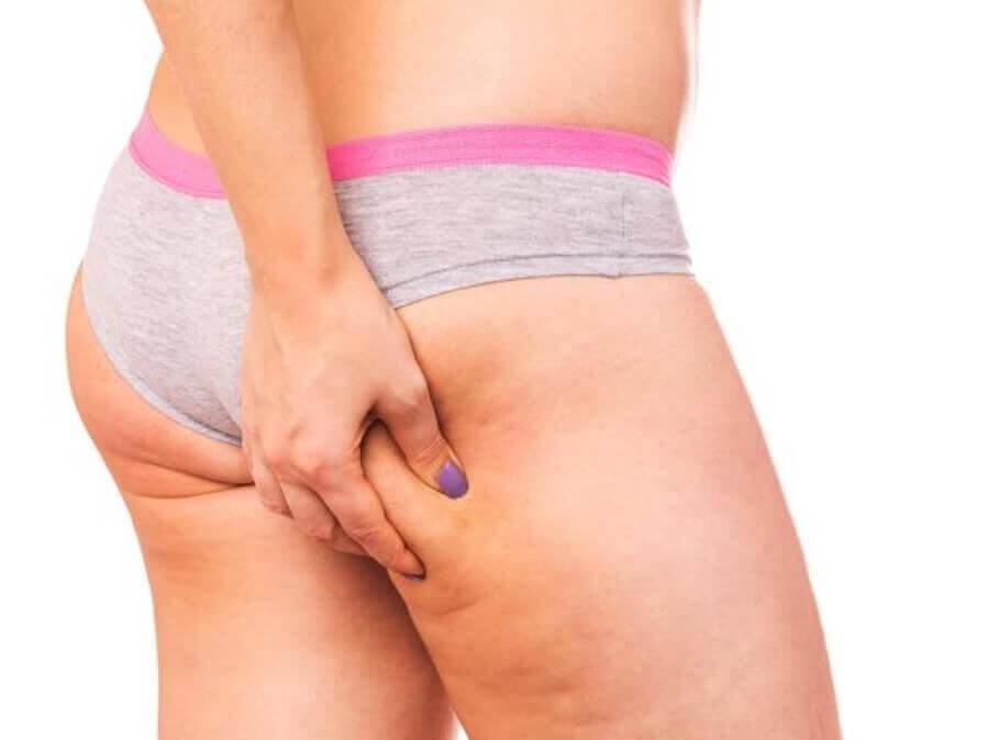 Cellulite verschlimmern: Oberschenkel