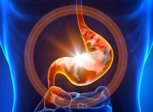 Natürliche Heilmittel gegen Gastritis