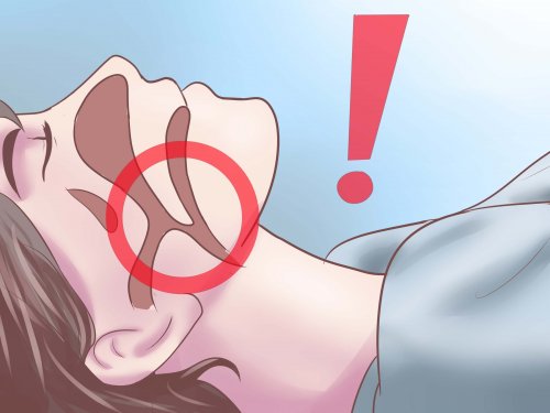 Schlafapnoe behandeln durch Gesichtsbewegungen