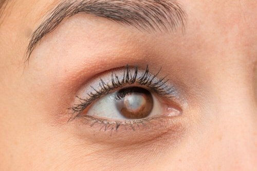 Die Vorteile von Karotten bei Augenproblemen