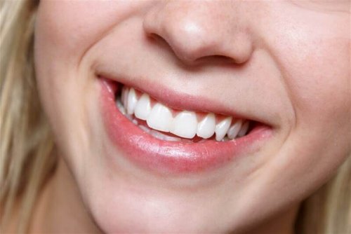 Naturjoghurt als Heilmittel für strahlend weiße Zähne