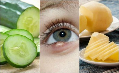 Gerstenkorn am Auge: Dise 5 Hausmittel helfen