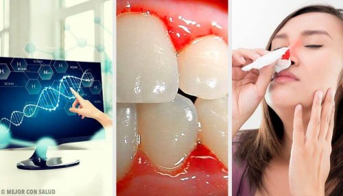 Mangel an Vitaminen: Das passiert mit deinem Körper