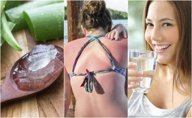 9 Möglichkeiten, einen Sonnenbrand zu behandeln