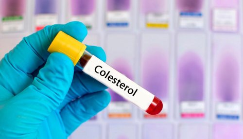 6 pflanzliche Heilmittel gegen hohe Cholesterinwerte