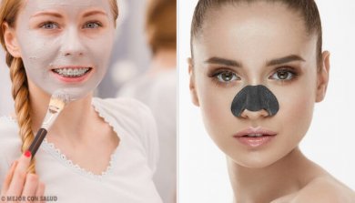 Masken zur Beseitigung von Mitessern