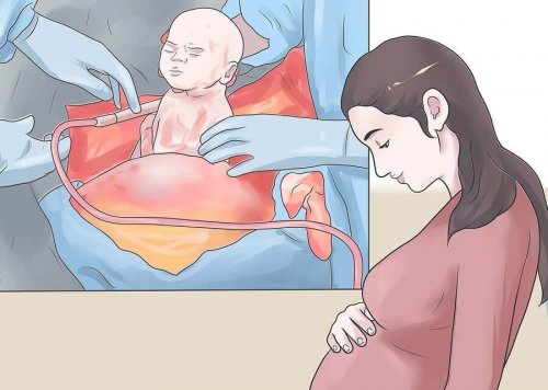 Nach einem Kaiserschnitt sollten Mütter besonders gut auf sich achten