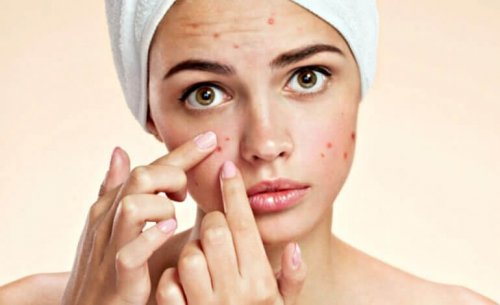 Zahnpasta gegen Pickel und andere wahre Beautytricks