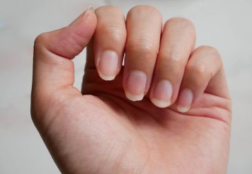 So wachsen brüchige Fingernägel gesund nach
