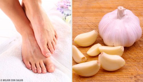 Behandlung eines eingewachsenen Nagels mit Knoblauch