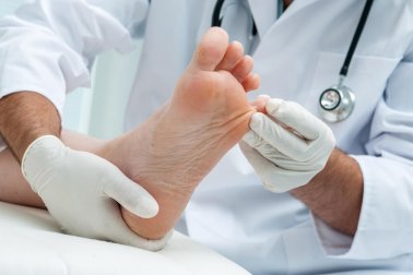 Pilzinfektionen der Haut: 7 natürliche Heilmittel