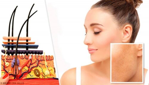 Hautflecken und ihre Ursachen