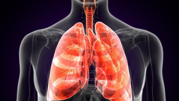 Was ist die Lungenpest und was sind ihre Symptome?