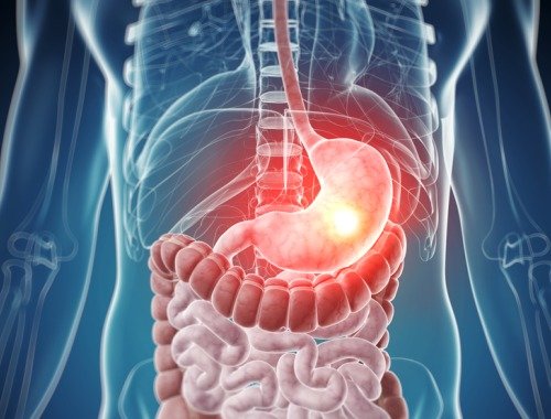 Wissenswertes über die häufigsten Lebensmittelunverträglichkeiten