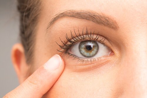 Diese Hausmittel helfen bei dunklen Augenringen