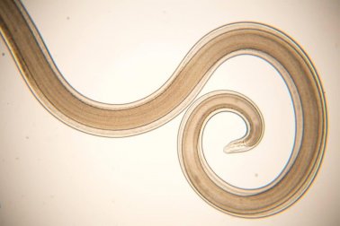 Milch mit Minze gegen Darmparasiten