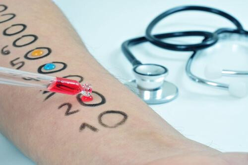 Allergietest je nach Patient