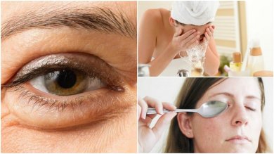 Schwellungen unter den Augen: 5 Tipps
