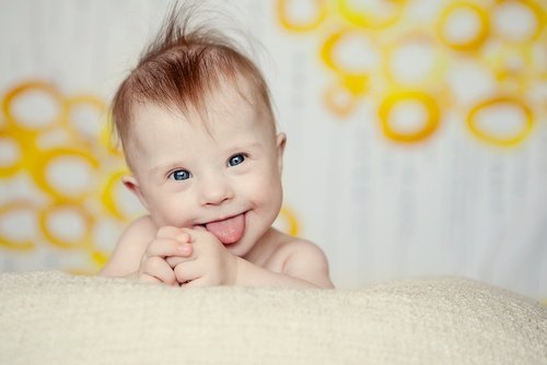 Baby mit Down-Syndrom