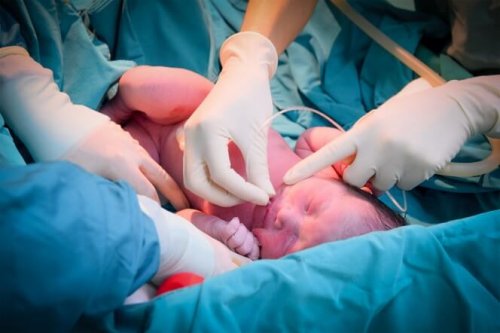 Baby nach Kaiserschnitt