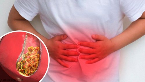 Patient mit Gallensteinen spürt Schmerz